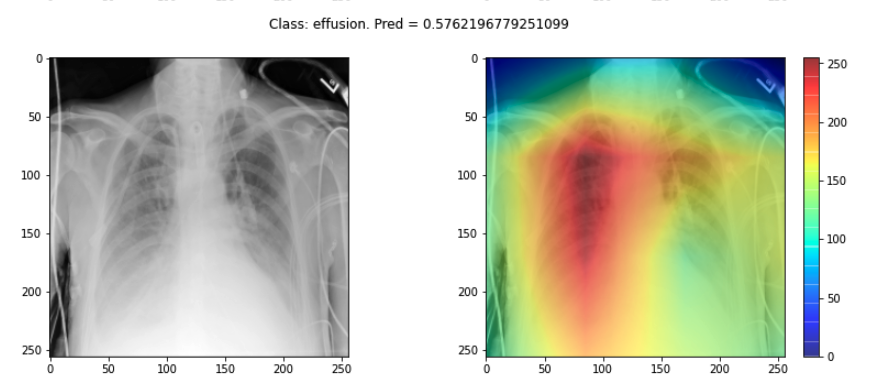 Saliency maps