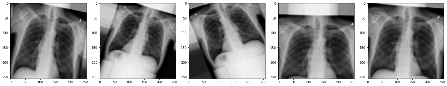 X-ray augmented